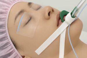 tapingeyesclosedanesthesia