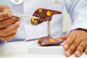 halothanehepatitis