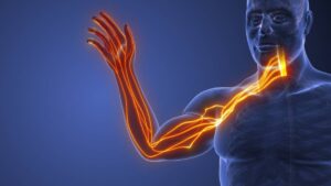 Rebound Pain After Peripheral Nerve Blocks