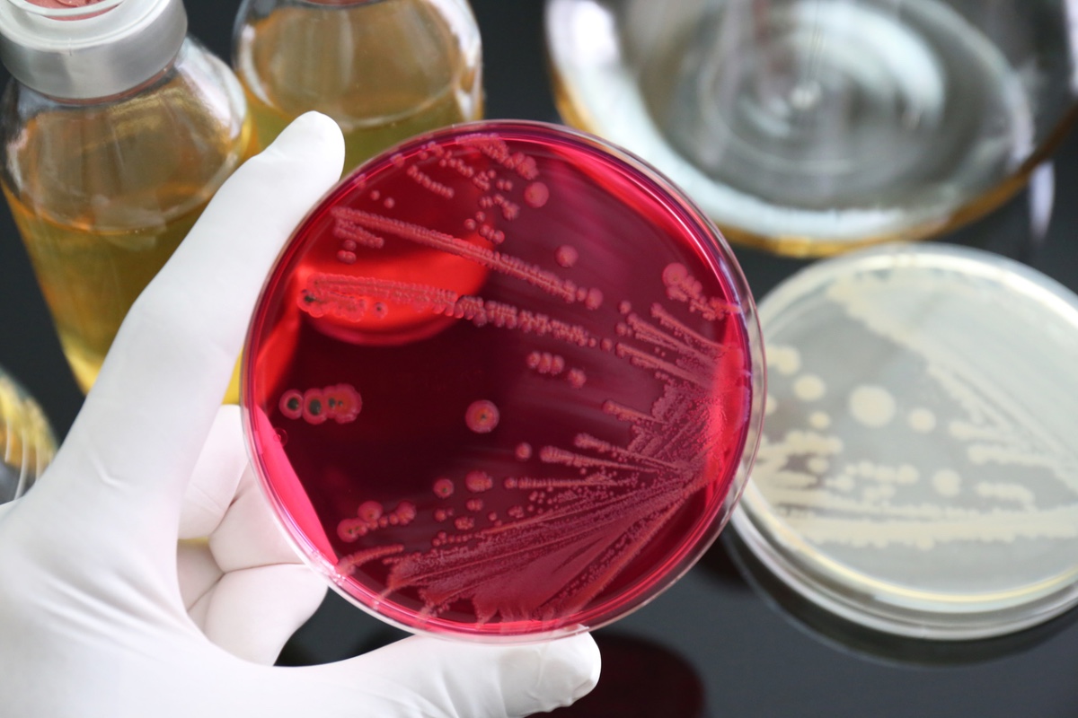 Infectious diseases
